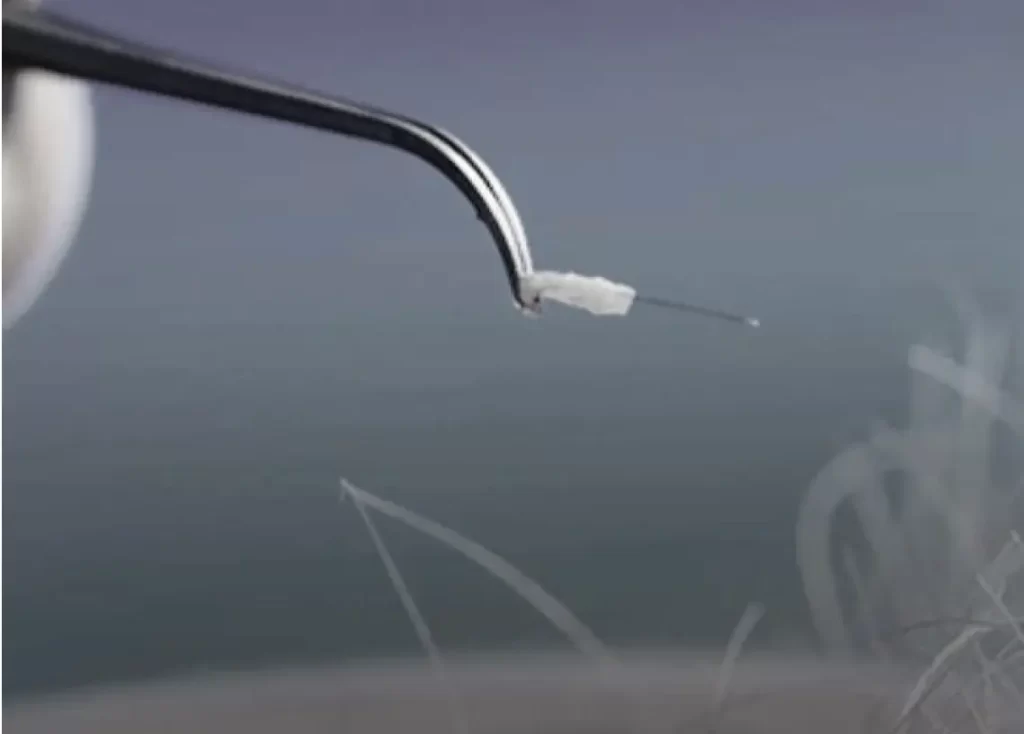 Medical team performing stem cell therapy for hair loss